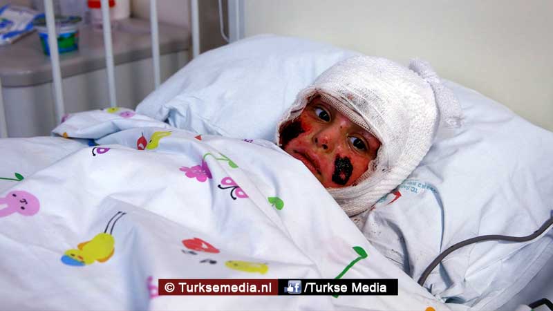 Turkije probeert zwaargewonde Syrische kinderen te redden