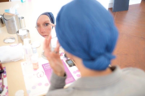Uiterlijk belemmert vrouwen met kanker
