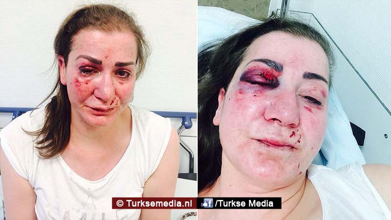 Turkse vrouw aangevallen in tram