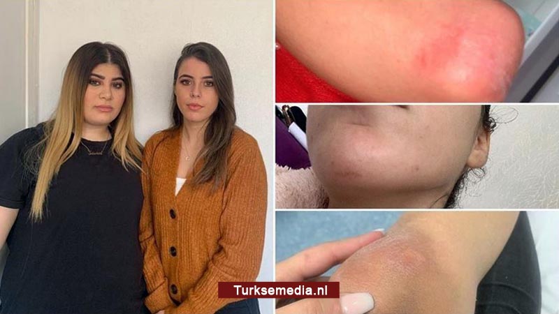 Franse politie mishandelt Turkse vrouwen