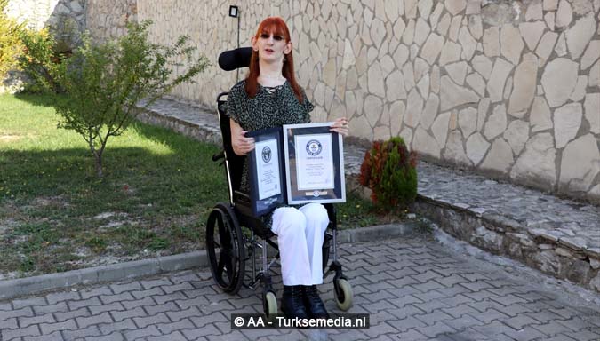 Turkse Rumeysa is langste vrouw ter wereld - Turkse Media - Exclusief